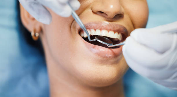 Best Knocked-Out Tooth (Avulsed Tooth) Treatment in Edgard, LA